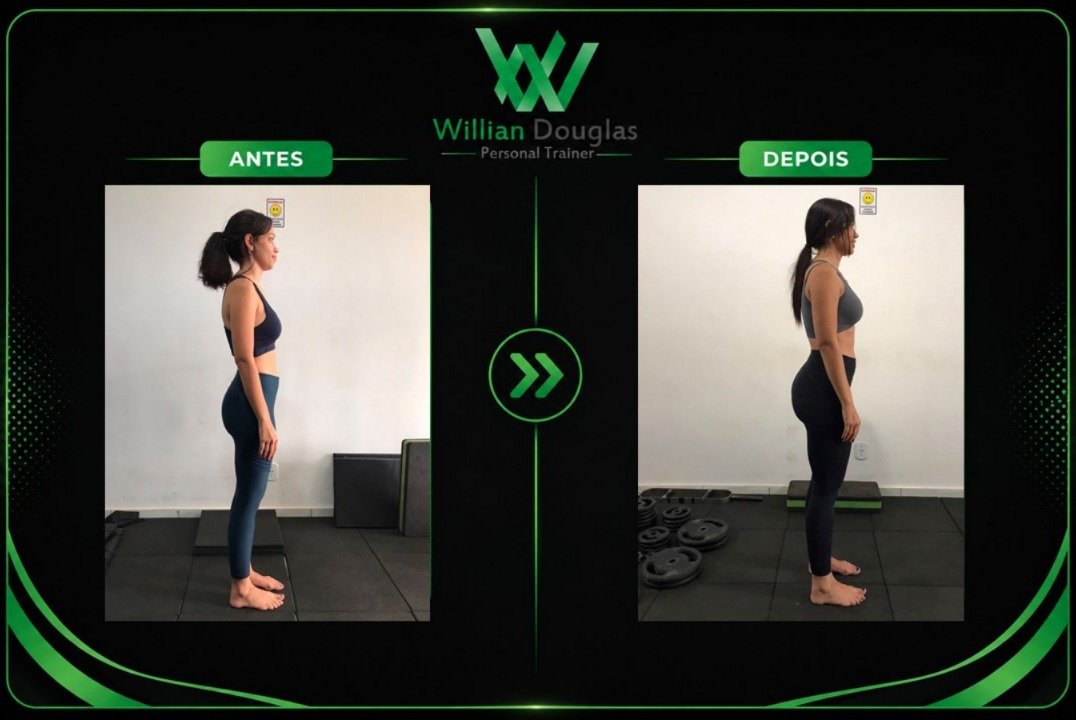 Brunna Lopes — antes e depois