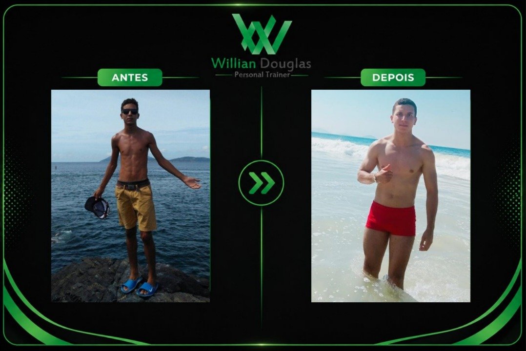 Lucas Emanuel — antes e depois